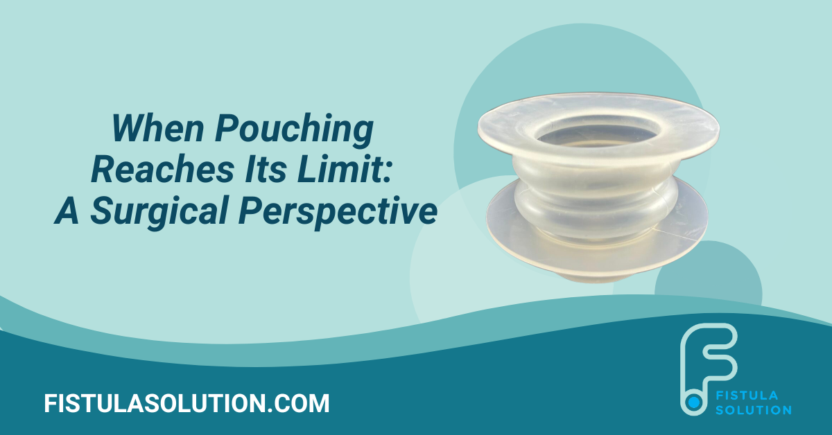 Wound Crown isolation device used to assist pouching in complex fistula and stoma management cases.
