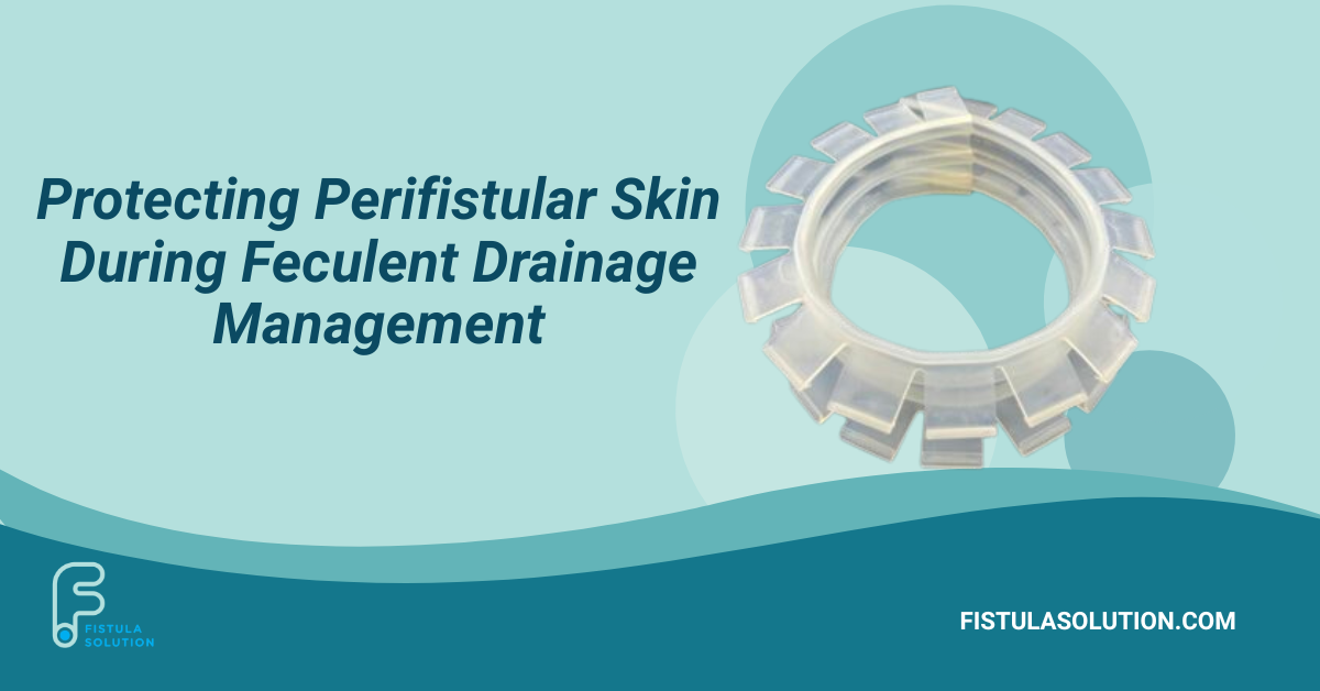Isolator Strip supporting protection of perifistular skin during feculent drainage management in complex fistula care.