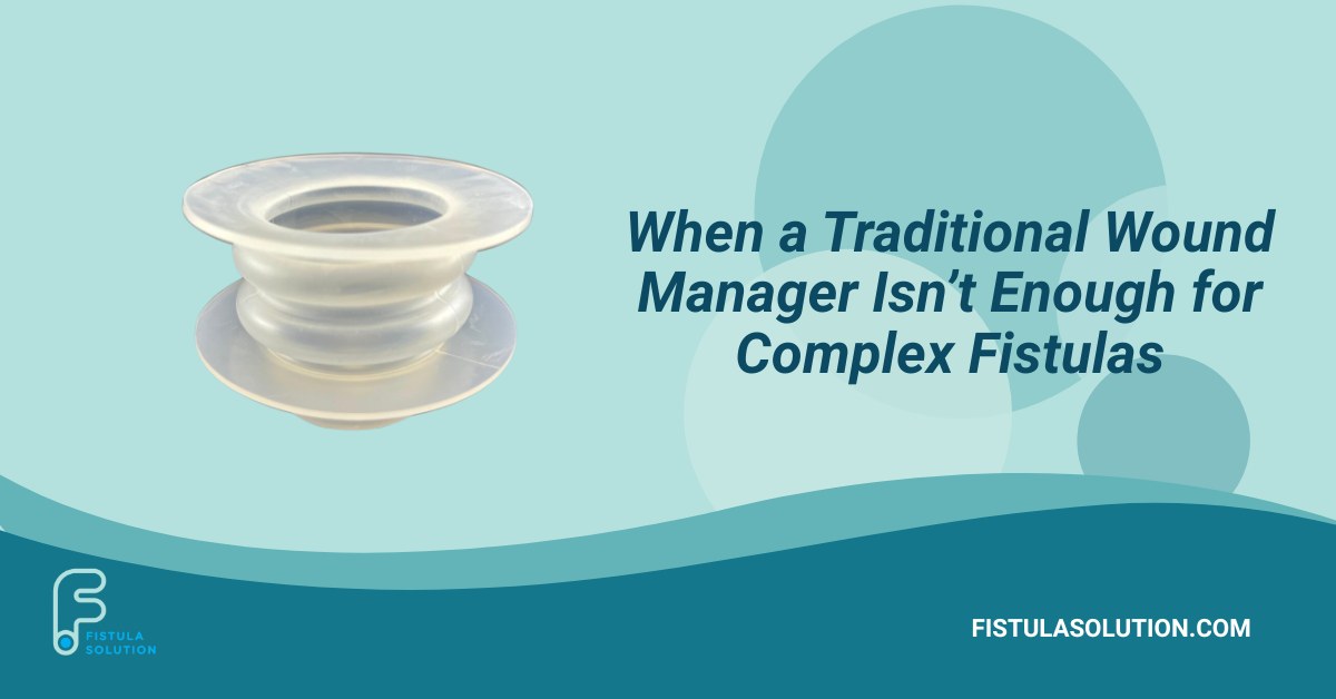 Wound Crown shown for complex fistula management when a traditional wound manager is no longer effective.