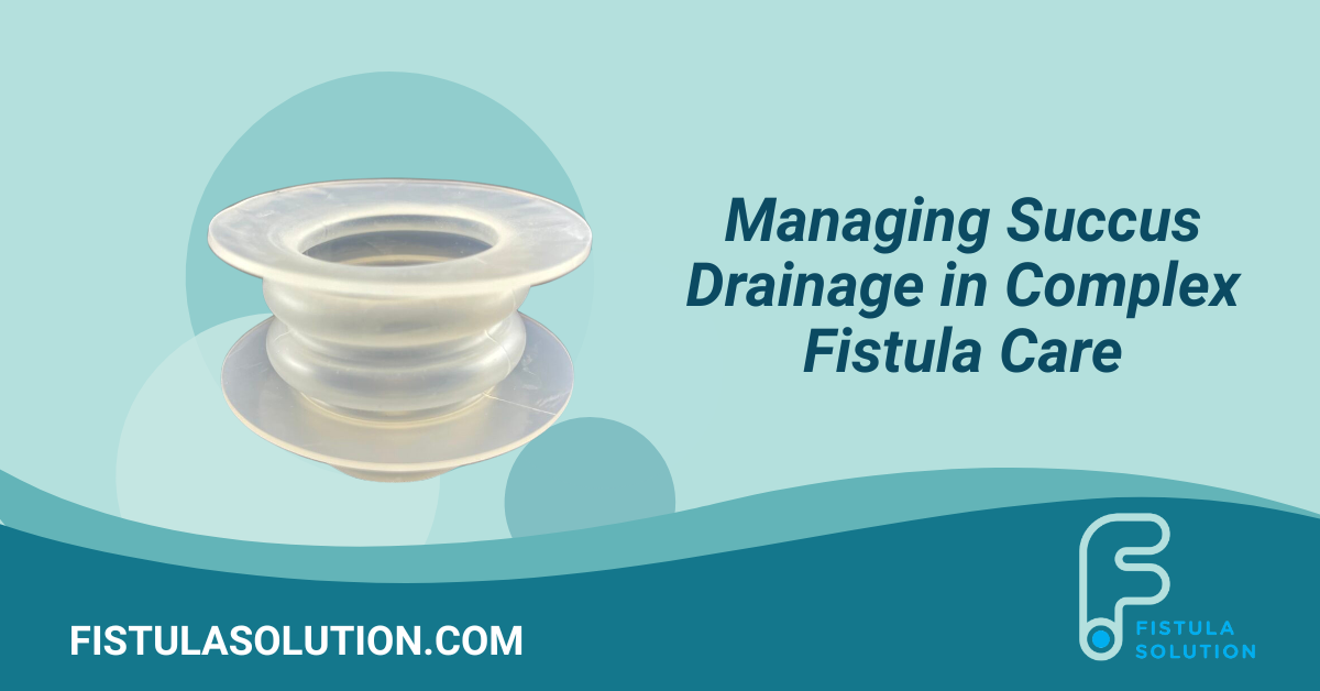 Wound Crown for managing succus drainage in complex fistula care.