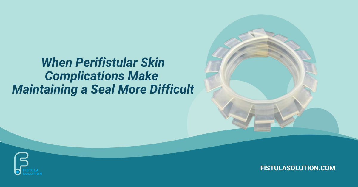 When Perifistular Skin Complications Make Maintaining a Seal More Difficult